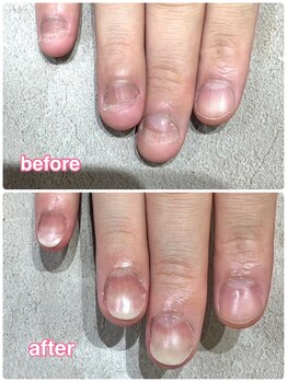 グレースレディ 神戸北店/