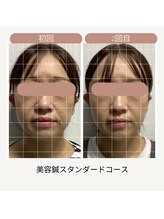 サロン ド ハリッシュ(Salon de HARISH)/顔の左右のバランスにも◎