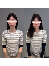 プライミー(PRIMY)/小顔矯正！ビフォーアフター