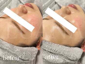 ルアナ(LUANA)/ララピール