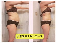 ヨサパーク アリナ(YOSA PARK Alina)の雰囲気(試す価値あり!感動のビフォーアフター。)