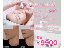 メシダ(脂肪分解剤)×LDMで部分的に引き締められる★