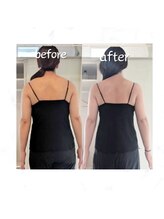 ユーニマルヨン(ewe204)/ブライダル8回コース