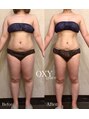 オキシー グレイス 黒崎店(OXY Grace)&nbsp;30代9ヶ月Before.Afterマイナス12キロ
