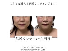 シュクラン(SHUKRAN)の雰囲気（ボディ×フェイシャルコースで1度でも驚きの変化に！）