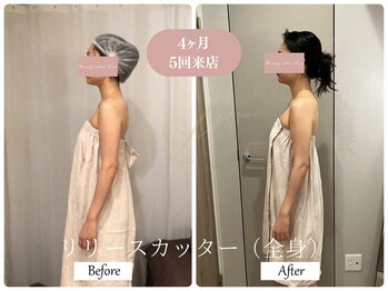 リノ(Lino)/肩こり改善で4ヶ月ご来店♪