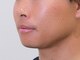 メンズクララジャパン 広島店(MEN'S CLALA JAPAN)の写真/【笑顔に自信を!】タバコやコーヒーの着色汚れを徹底ケア!清潔感のある本来の自然な白い歯を取り戻す!