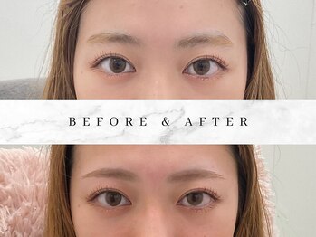 ナキ 富山店(Naki)/眉毛施術例 (眉毛Before.After)
