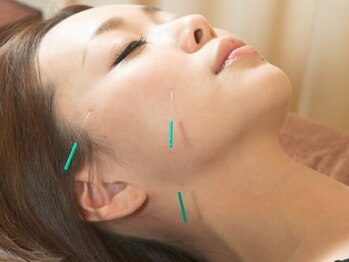 カラダノミカタの写真/当院で人気の美容鍼★筋肉・筋膜などの状態に合わせたパーソナルケアをご提供♪