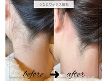 ビエル(VIERU)/うなじワックス脱毛