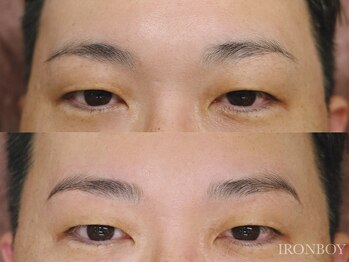 アイロンボーイ(IRONBOY)/メンズ眉毛矯正パーマ|眉毛矯正