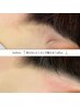【人気部位】うなじ脱毛 2,200円