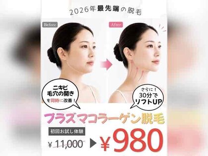 リズベット(LIZ BET)の写真
