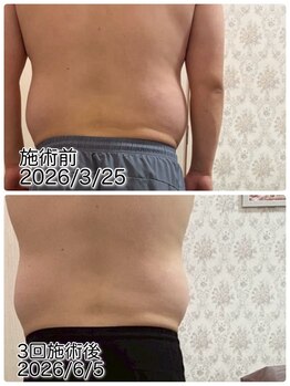 クールスパ(COOL SPA)/20代男性