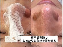 クリアホワイト(Clear White)/隠れていた汚れが出てくる？