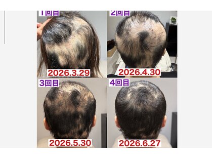 サロンノコ(salon NOKO)の写真