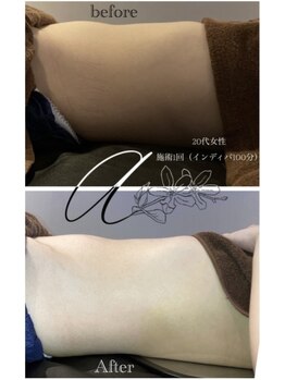 アランシア(Arancia)/