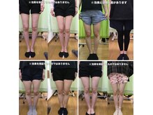 さくら整体院の雰囲気（О脚矯正に自信があります。）
