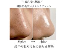 ルブラン(Lu'Bulan)の雰囲気（韓国肌管理特化サロン☆毛穴ケア/ニキビケア/エイジングケア◎）