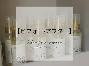 エステプリヴェモロッコ(ESTHE PRIVE MOROCCO)/ビフォー/アフター