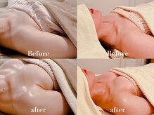 ローズルート(Rose route)/←20代前半 →30代前半 バスト