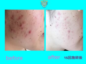 リュクス(LUXE)/ビフォーアフター