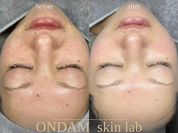 オンダム 表参道(ONDAM)/多方面からアプローチ