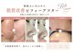 ベルシャトン(Belle Chaton)の写真