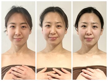 プルム(PURUMU)/くすみのない透明感のある小顔へ