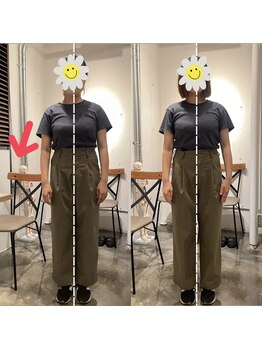 ピエール ナリタイラボ 薬院店(Piel NARITAI LABO)/肩の左右差の変化♪