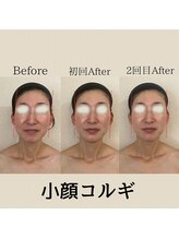 リーブル(LIBRE)/小顔コルギ　2回