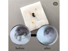 オスマンサス(Osmanthus)/before→after