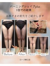 メディカルエステサロン ローズ 鯖江店(ROSE)/1回でこんなに変わる！