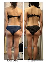 リープ(Lieb)/ボディビフォーアフター