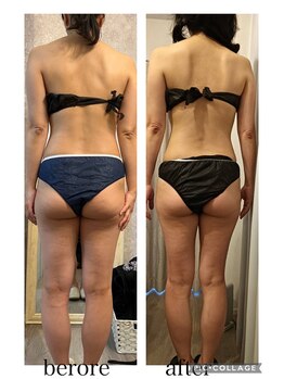 リープ(Lieb)/ボディビフォーアフター