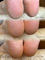 ベベ(Bebe)&nbsp;月一のサロンケア+毎日保湿のホームケアで綺麗な足裏を保つ♪