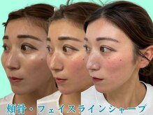 ナチュラルビューティーフェイス 横浜(NBF)