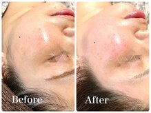 シシエル(CHICIEL)/フェイシャルワックス