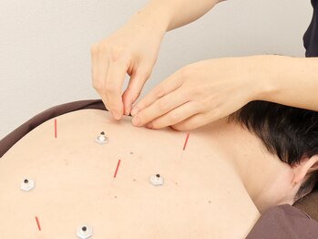 あかし整体院/慢性的な首肩凝り