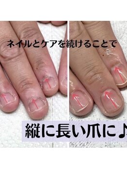 サロン エース(salon ace)/美爪育成