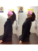 ヒデ整体院(Hide整体院)/猫背矯正骨盤矯正B/A肩こり腰痛