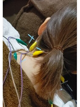 悠雲(ユウウン)/頚肩周りのツラさに鍼