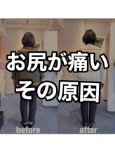 カワル整体 上通り院/お尻の痛みから解放されたい方