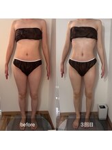 フィエルテ 甲斐敷島(FIERTE)/お客様 Before After