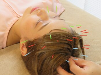 按鍼道の写真/【創業32年×ベテラン国家資格者】重だるい目とガチガチ肩を根本改善◎PCスマホ疲れに｜ペア施術歓迎◎