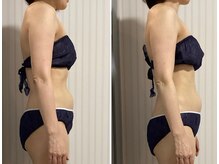 オリス(ORRIS)/肋骨の癒着改善でこんなの変わる