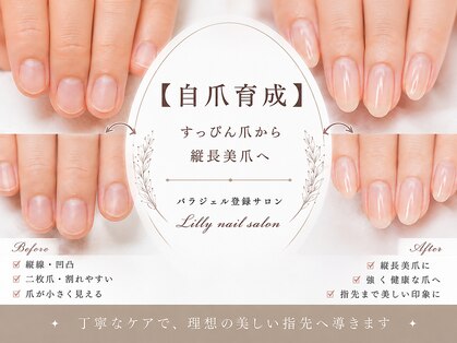 リリー(Lilly)の写真