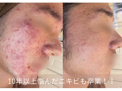ポアレ(POARE)の写真