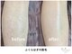 ヴィ オール(Vi.all)の写真/大宮で脱毛デビューしませんか？気になる脇やVIO、うなじへワックスと光のW脱毛をご提案！自信の持てる肌へ