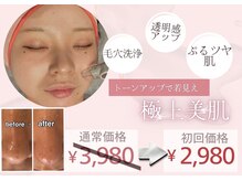 モア(MORE)の雰囲気（毛穴洗浄）